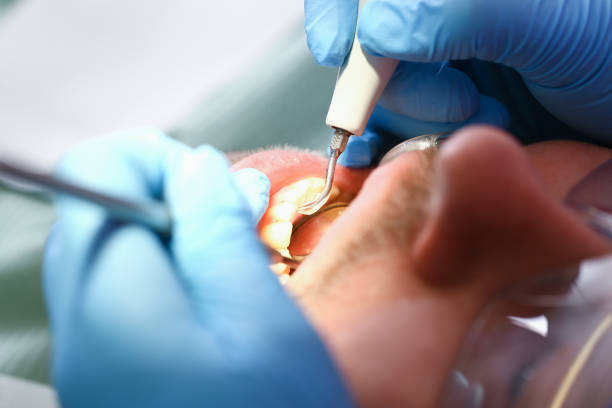Best After-Hours Dental Trauma Care in South Riding, VA