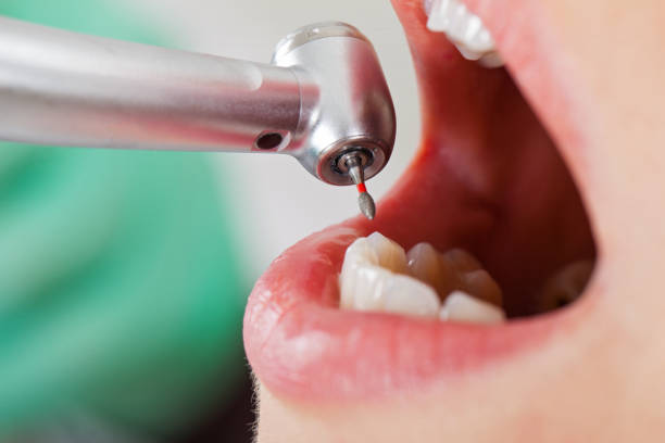 Best 24-Hour Emergency Dentist in South Riding, VA